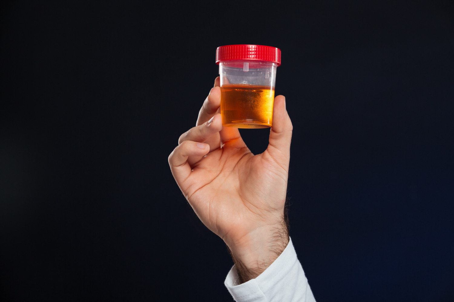 Complete Guide to Urinalysis: What It Is, Why It's Done, and What It Reveals